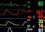 Monitor Herzfrequenz_270.jpg Monitor Herzfrequenz_270.jpg